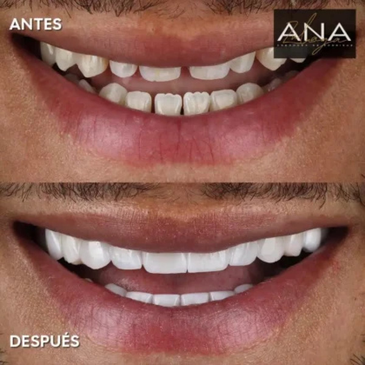 before and after photo