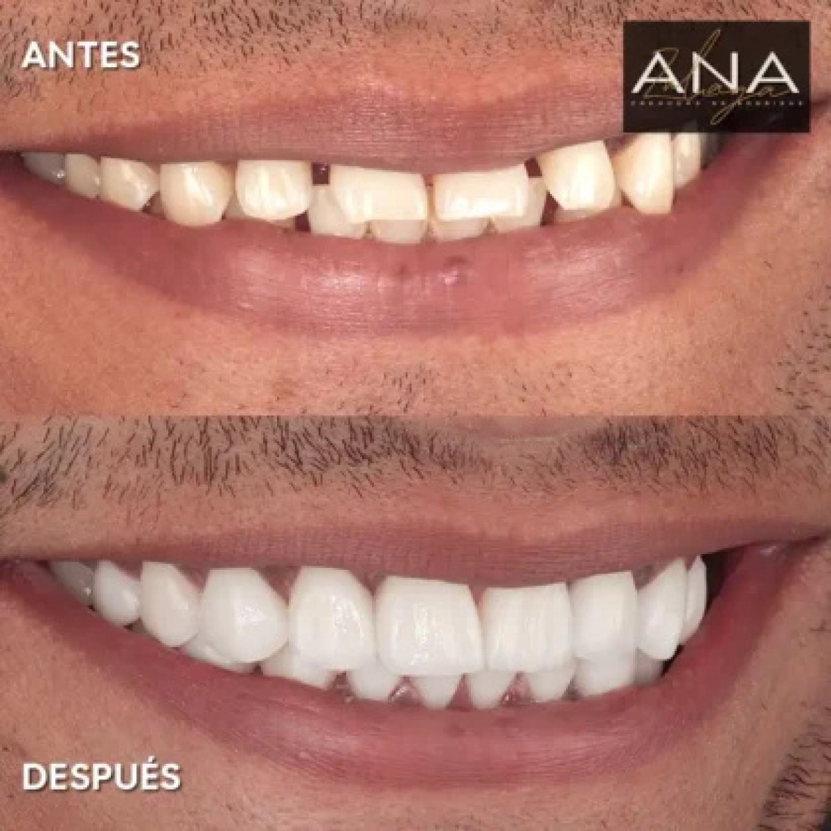 before and after photo