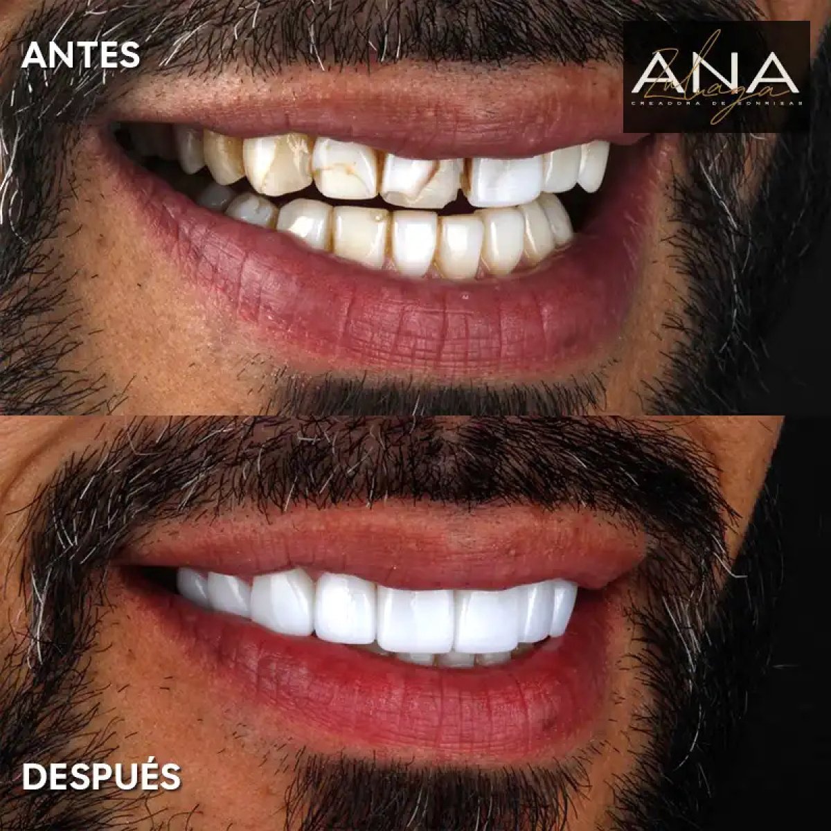 before and after photo