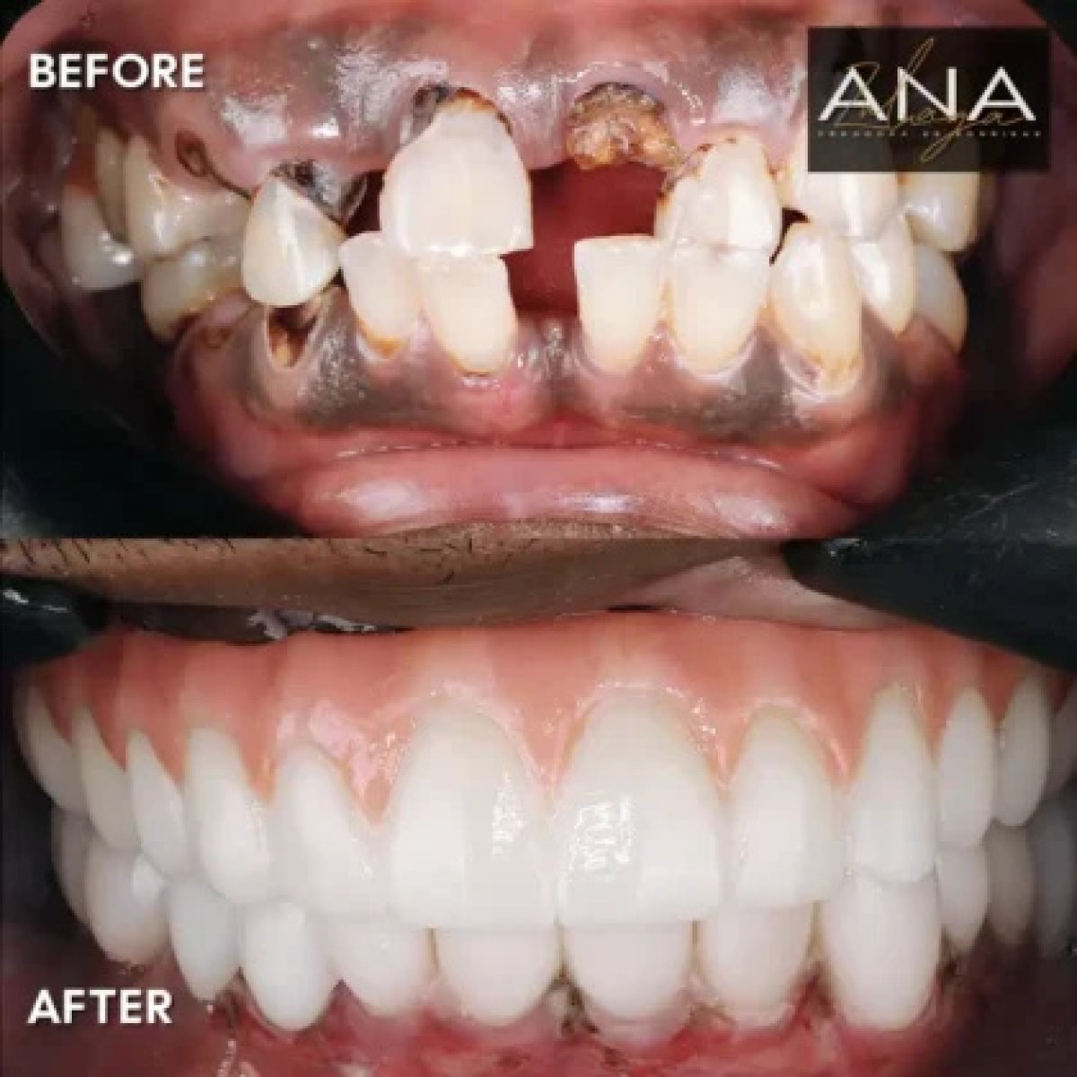 before and after photo