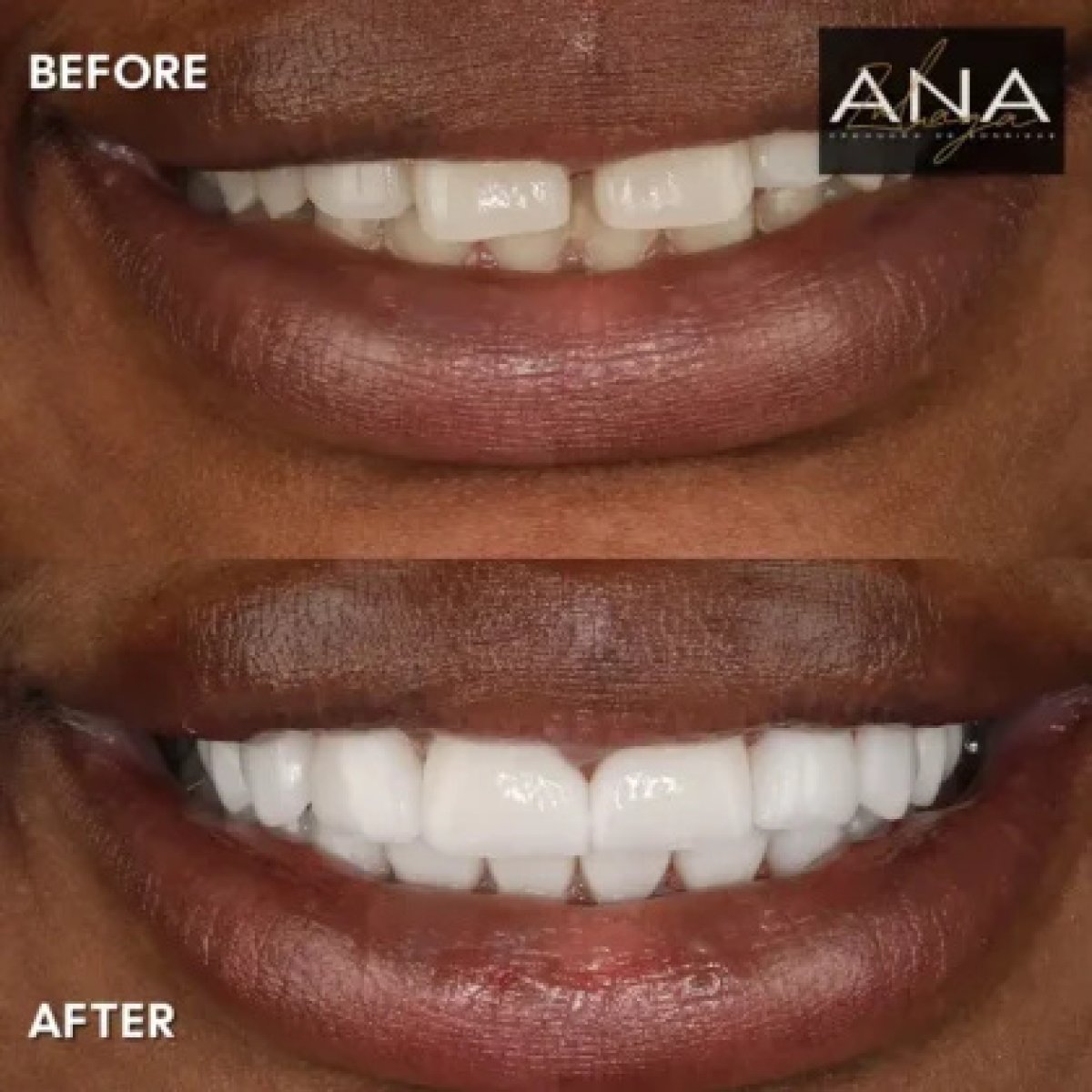 before and after photo