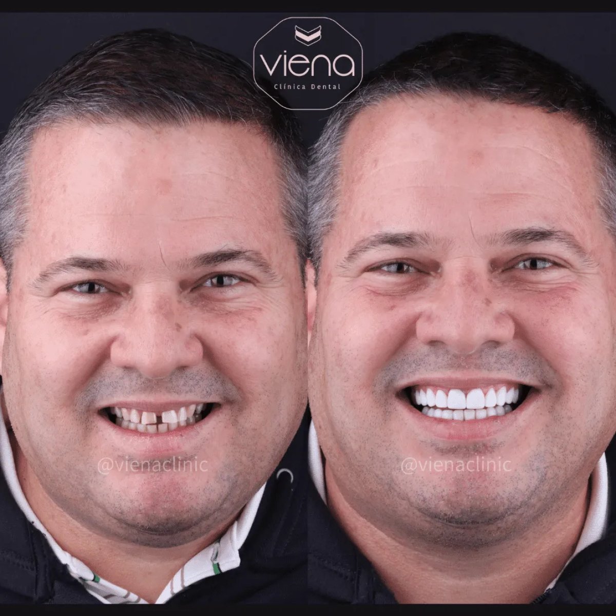 before and after photo