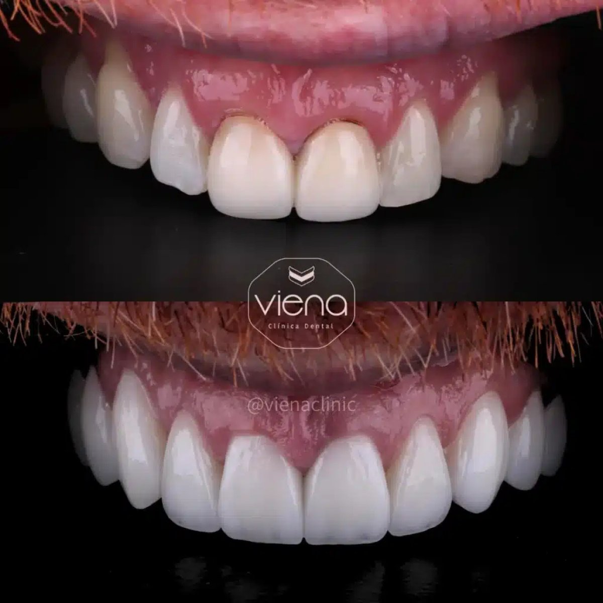 before and after photo