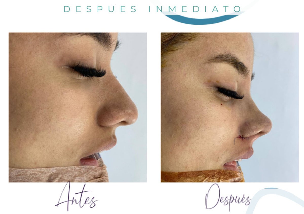 before and after photo