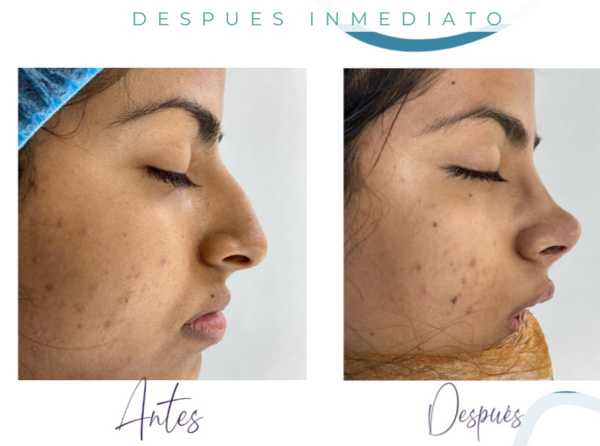 before and after photo