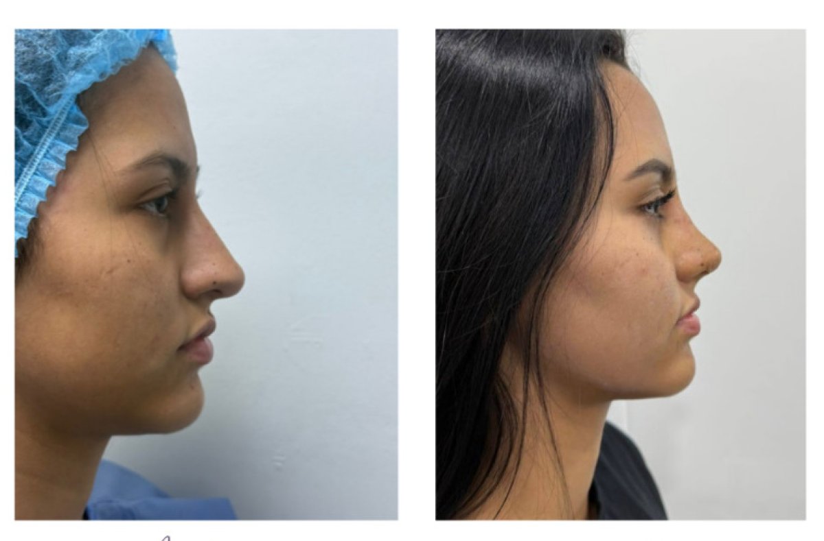 before and after photo