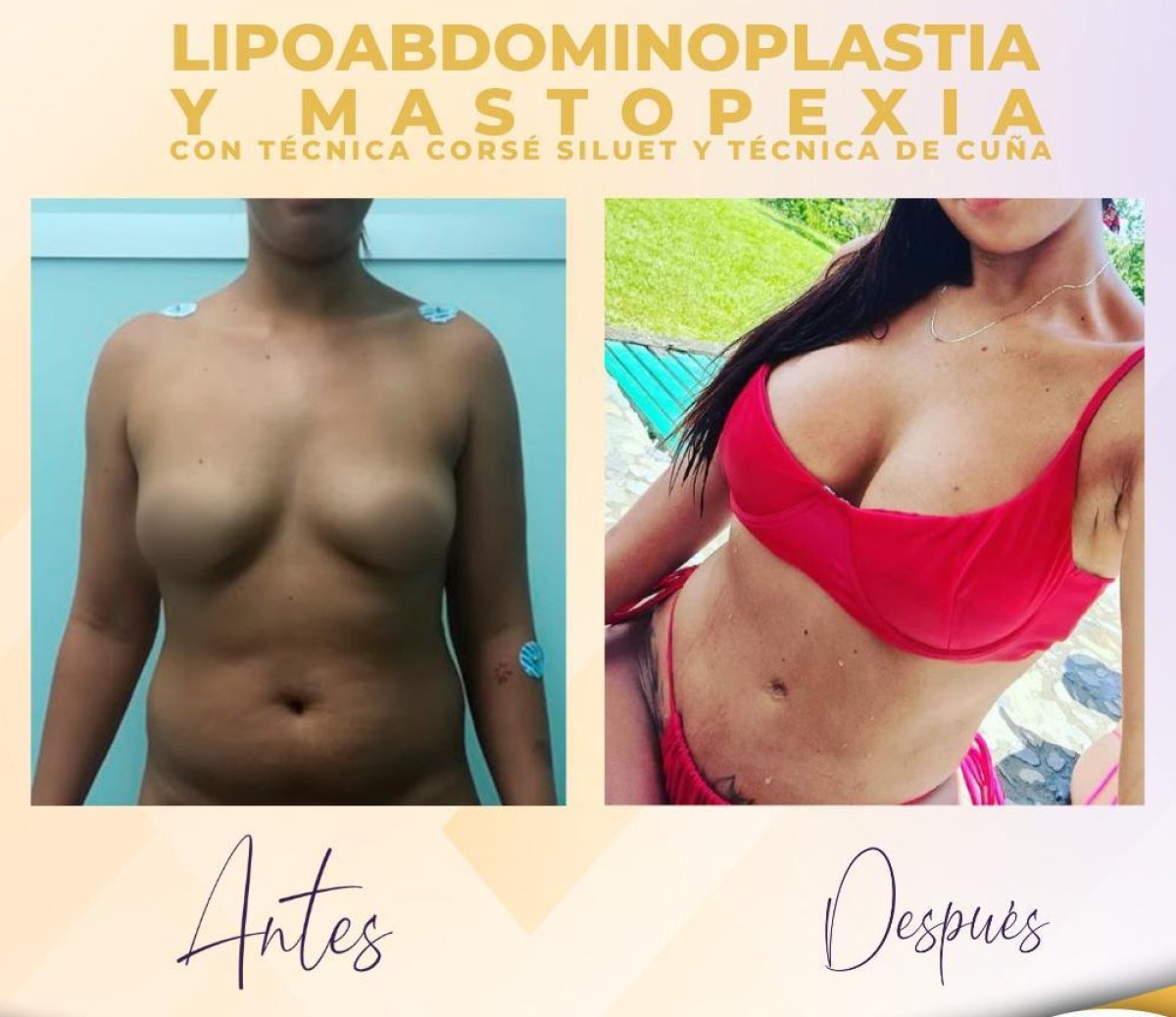 before and after photo