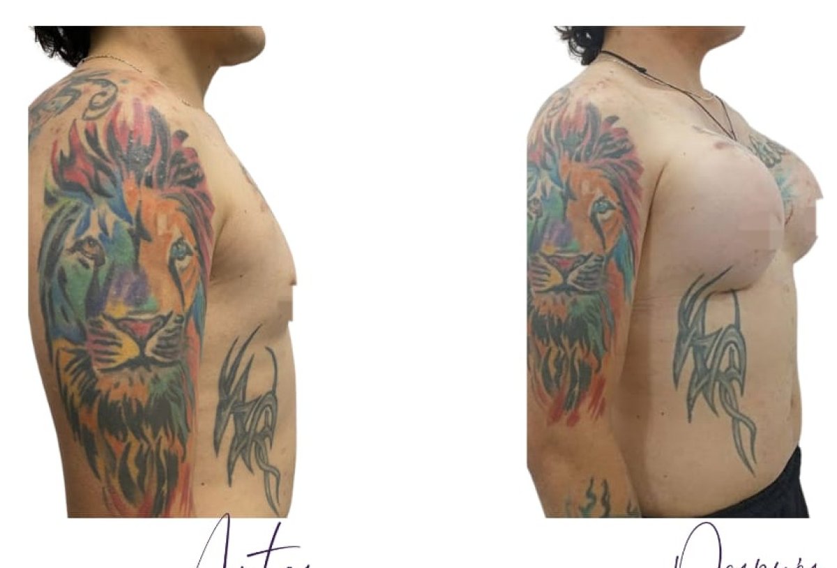 before and after photo