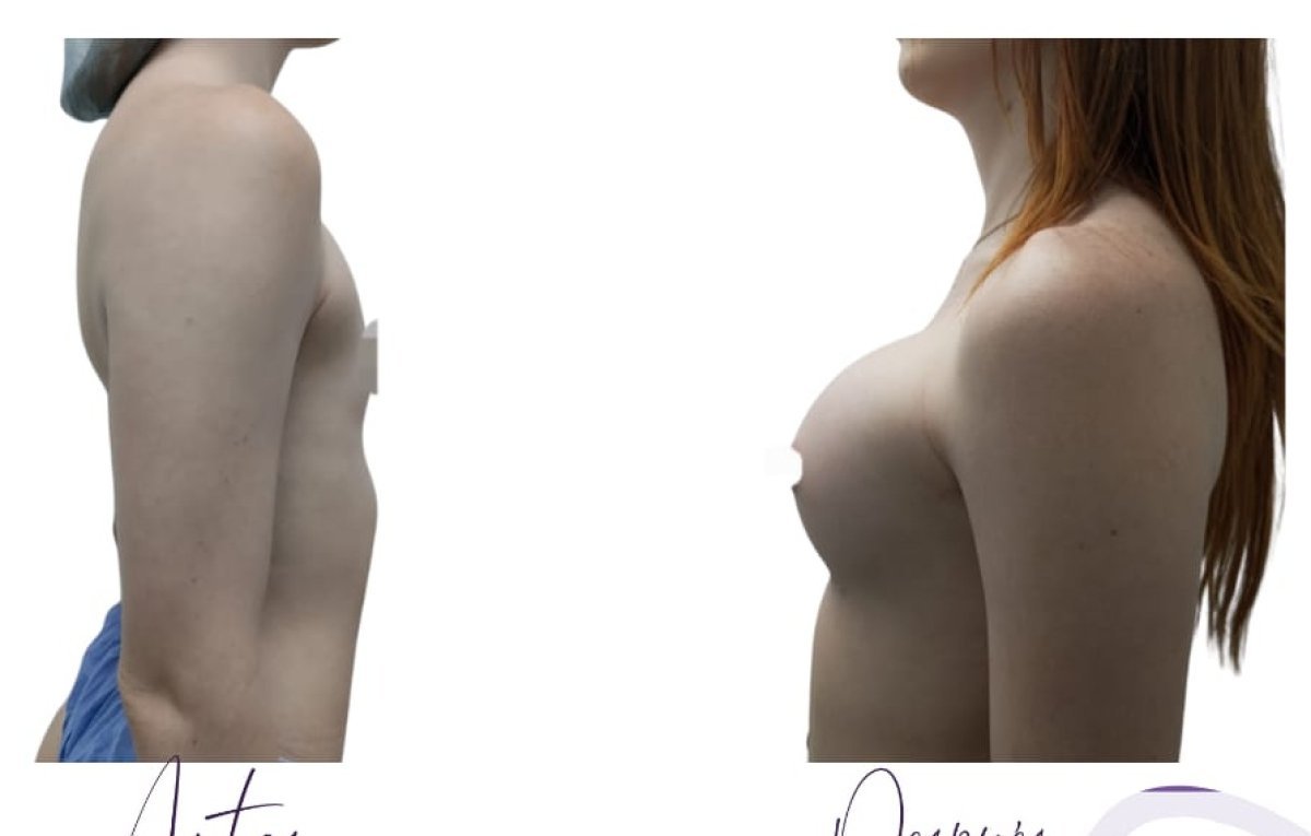 before and after photo