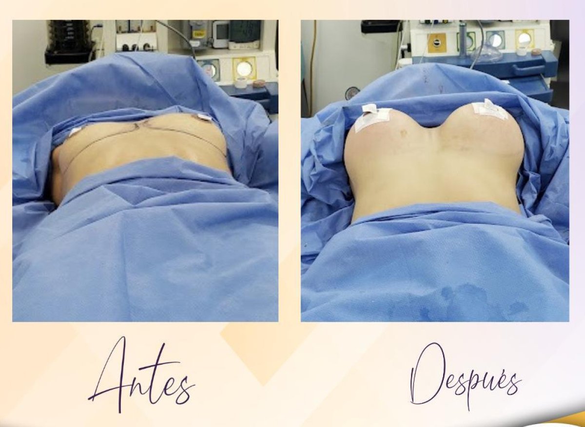 before and after photo