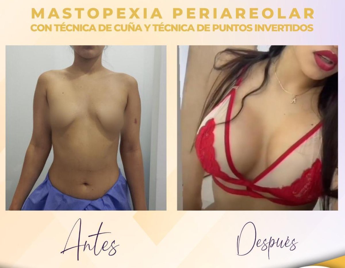 before and after photo