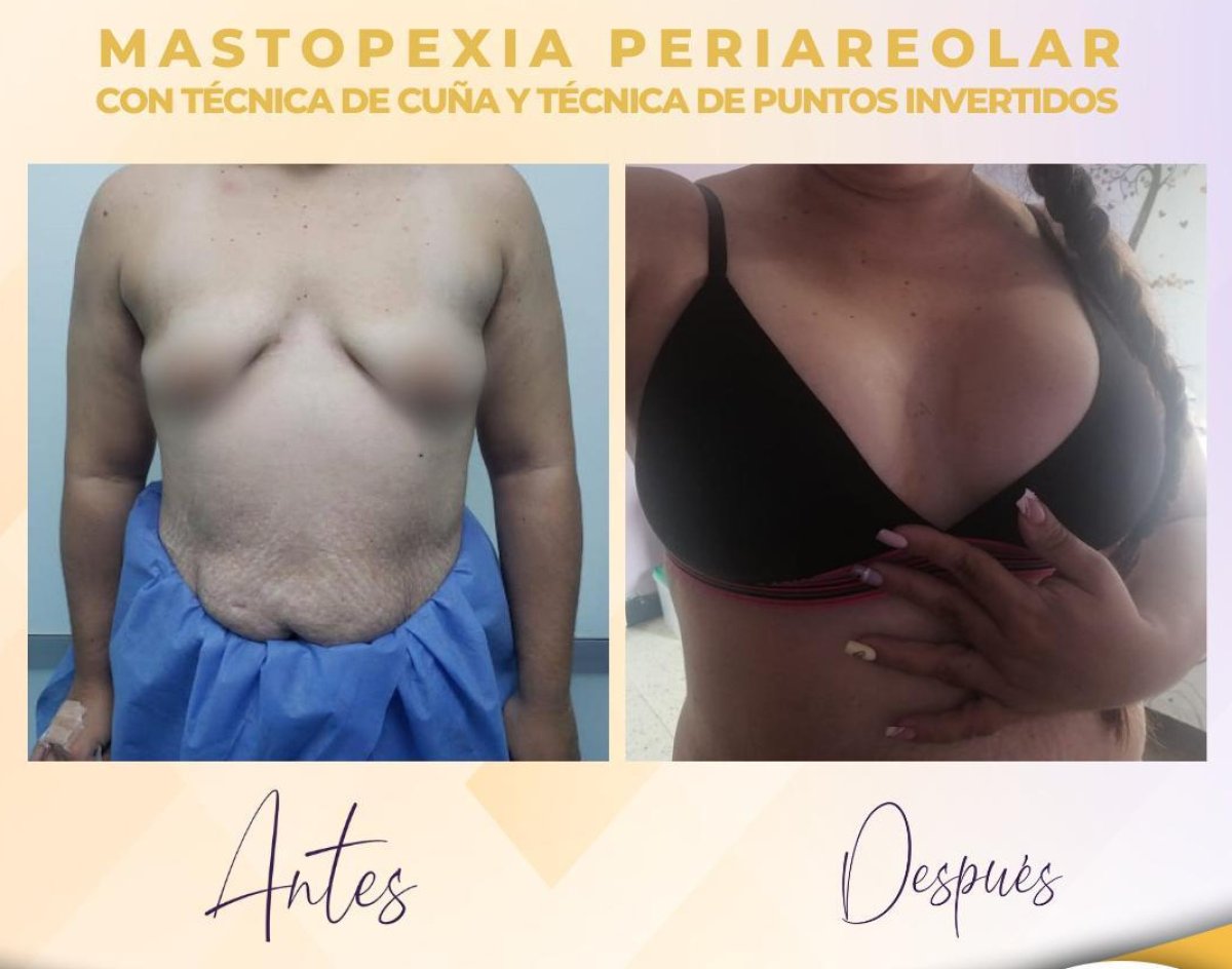 before and after photo