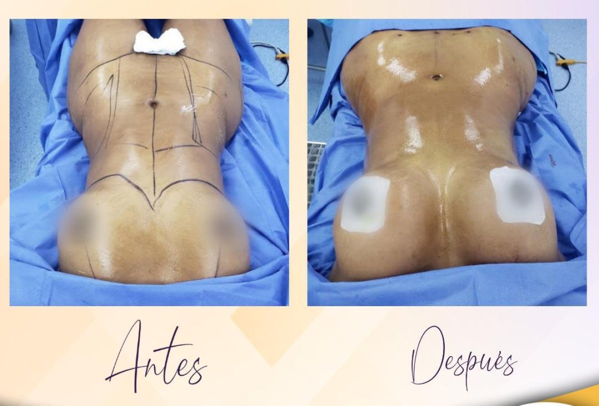 before and after photo