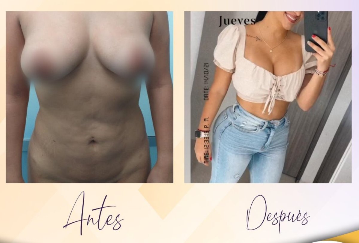 before and after photo
