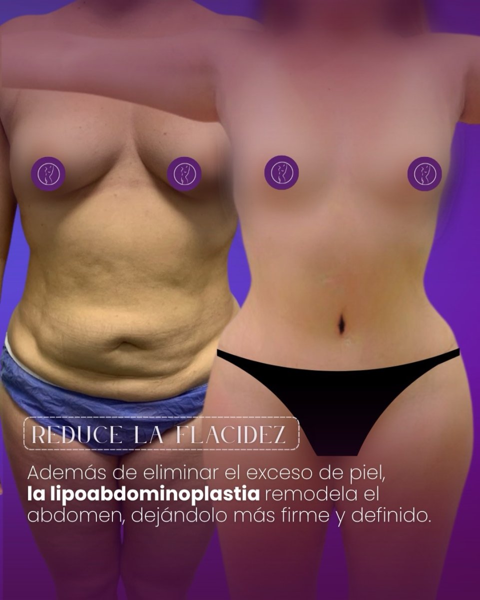 before and after photo