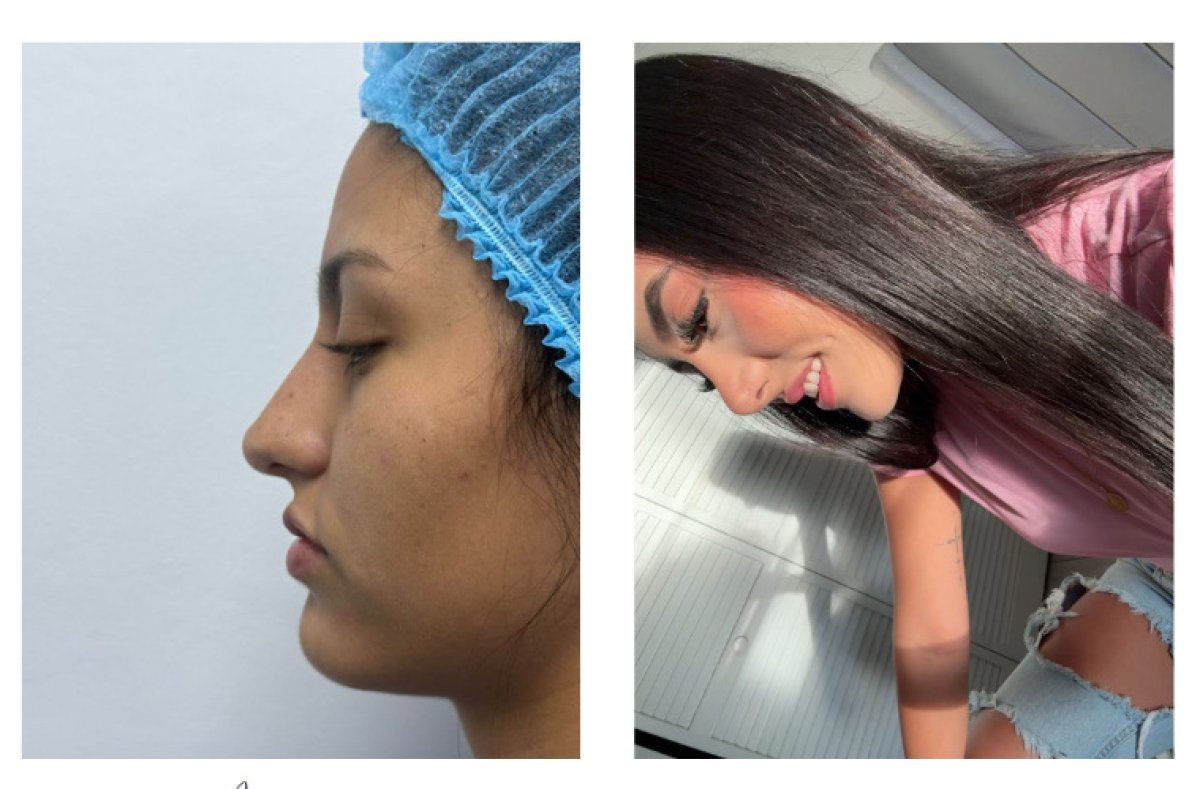 before and after photo