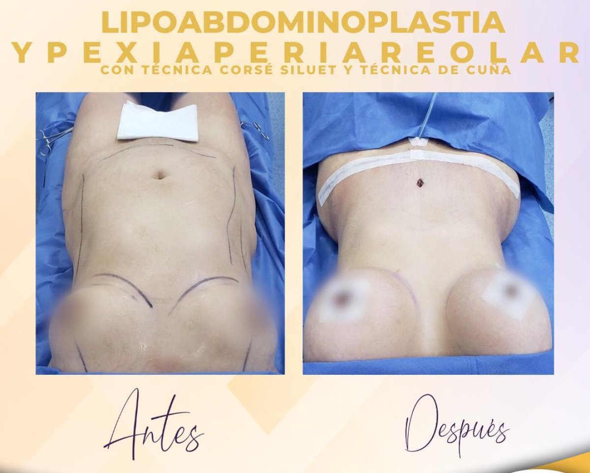 before and after photo