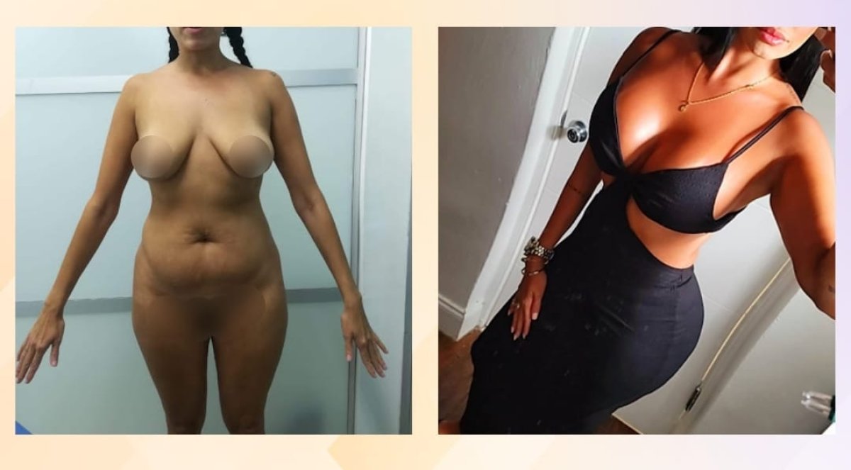 before and after photo