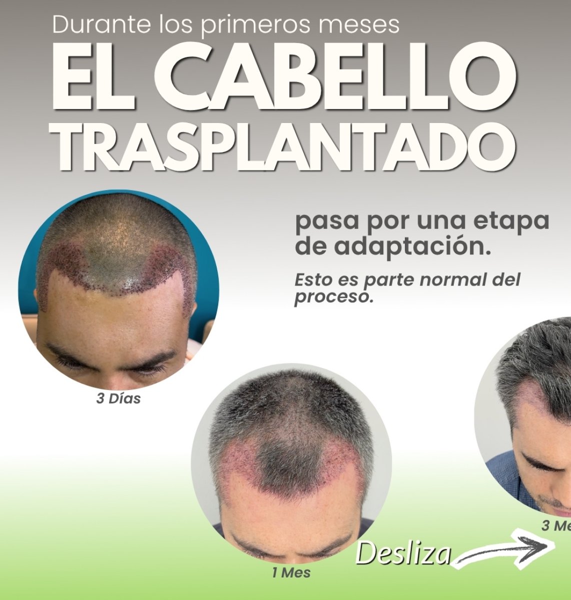 before and after photo