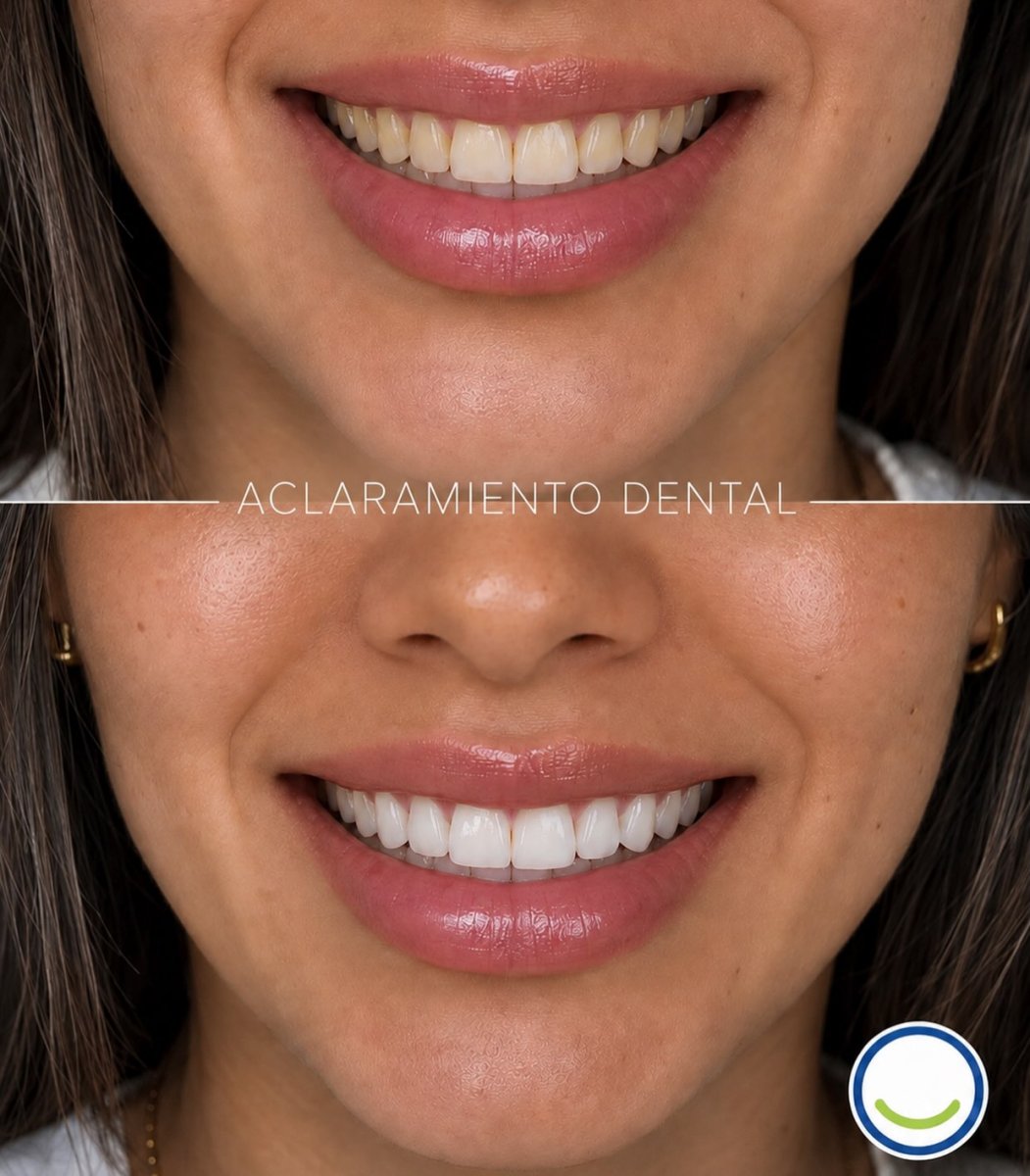 before and after photo