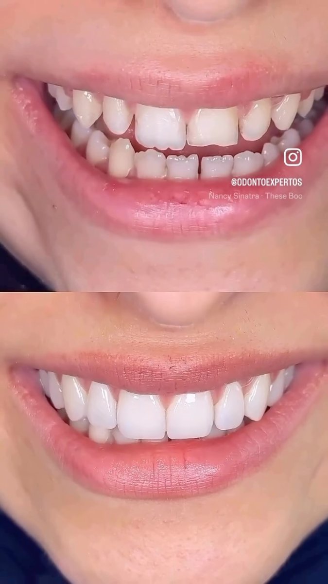 before and after photo