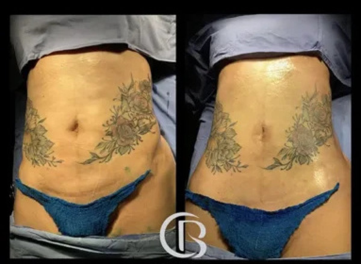 before and after photo