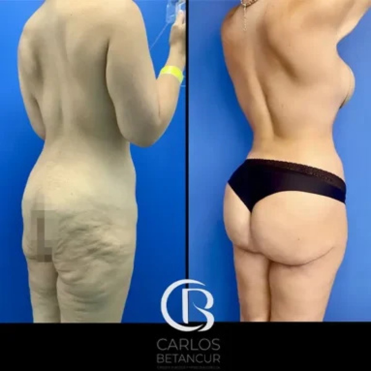 before and after photo