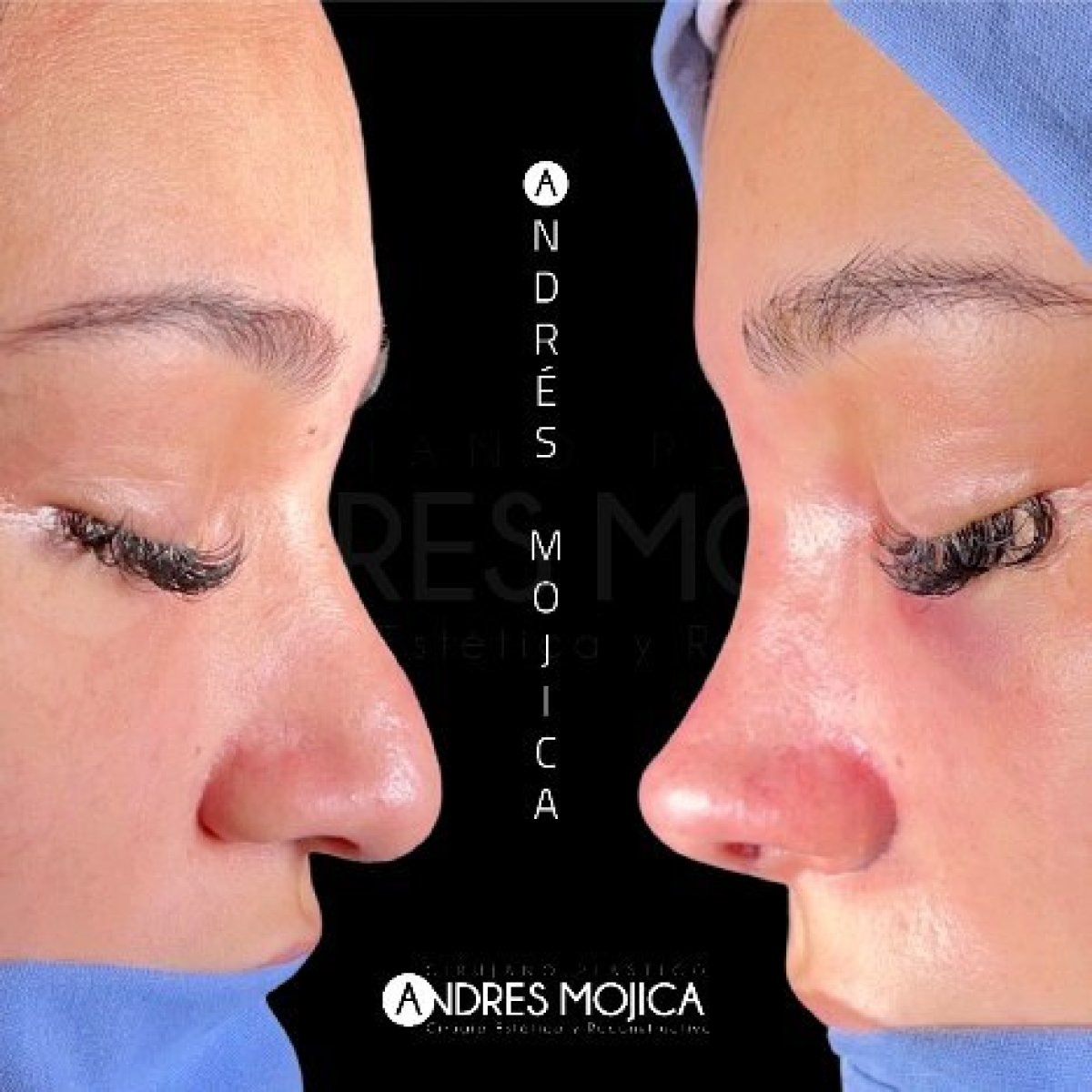 before and after photo