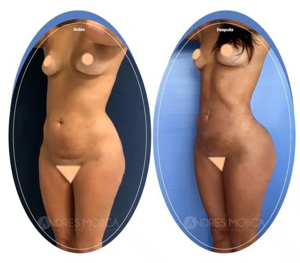 before and after photo