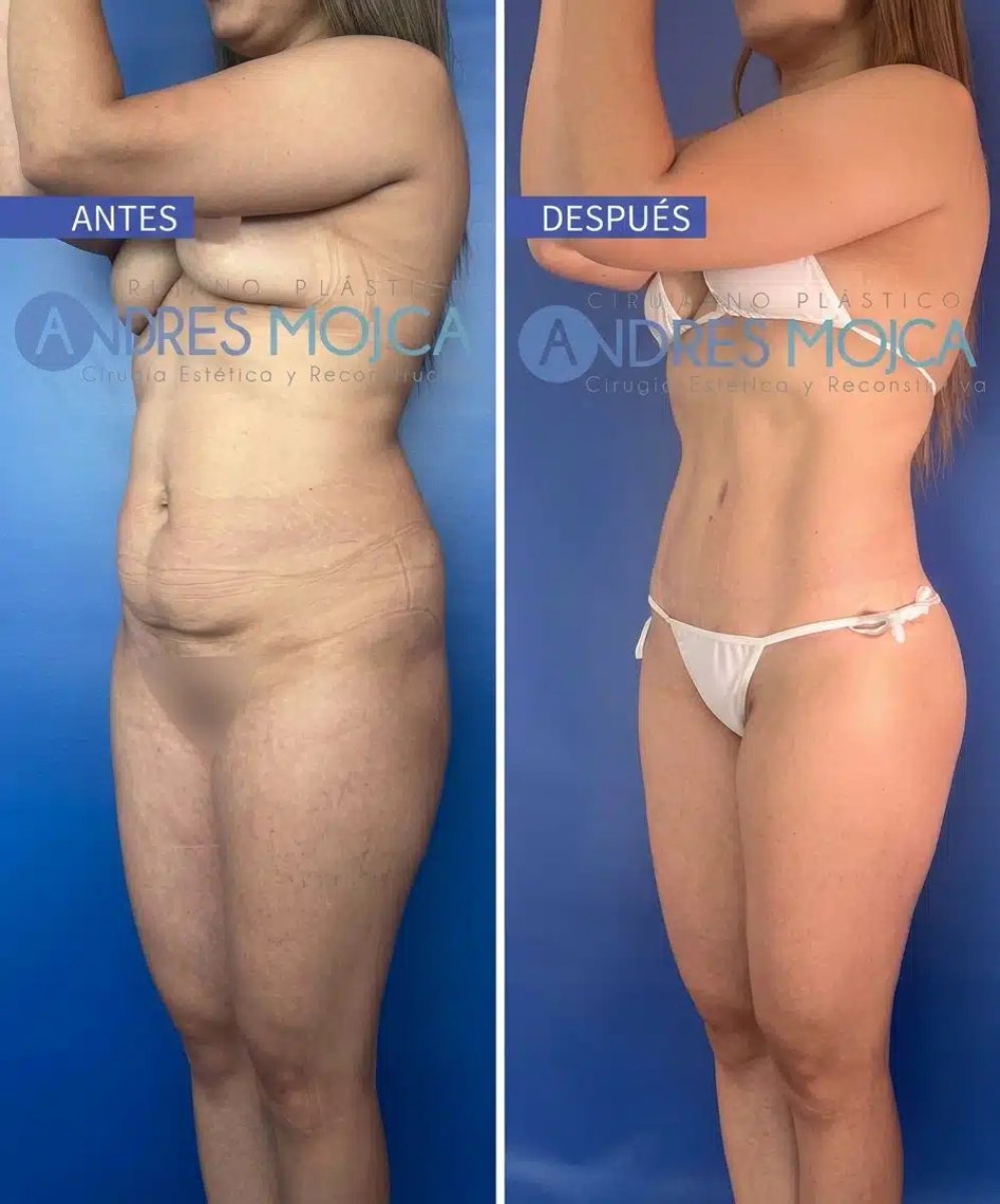 before and after photo