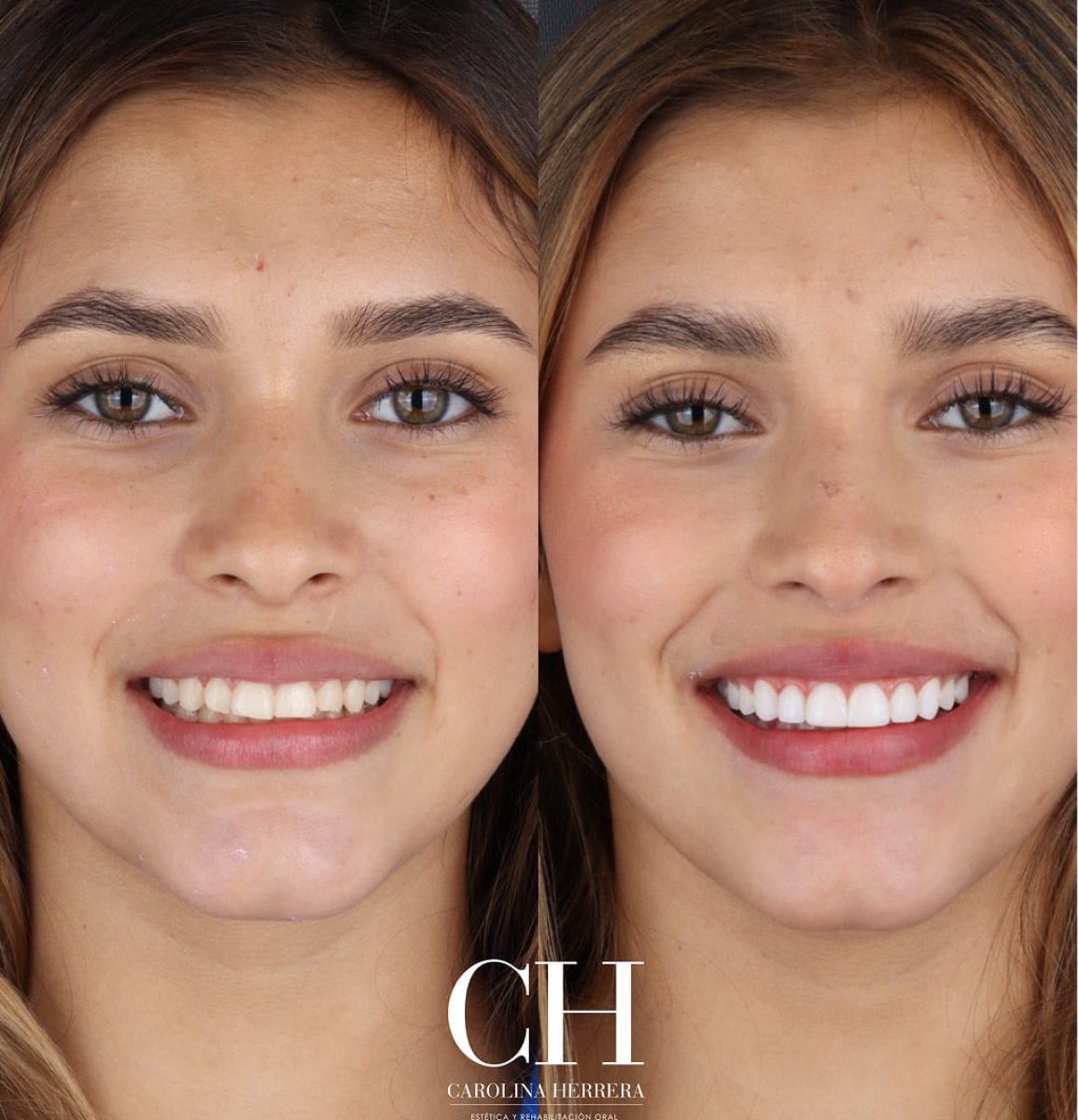 before and after photo