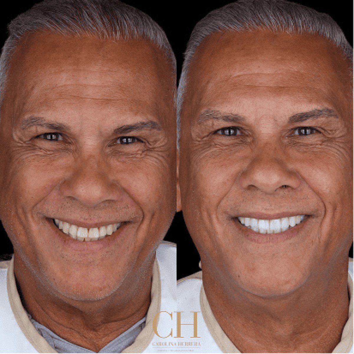 before and after photo
