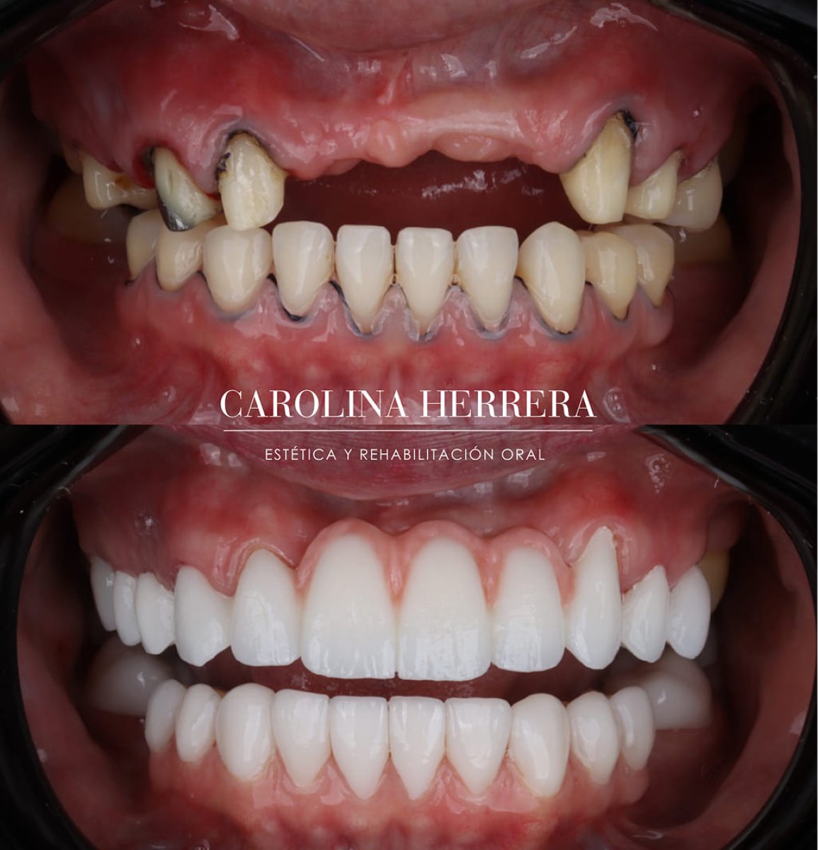 before and after photo