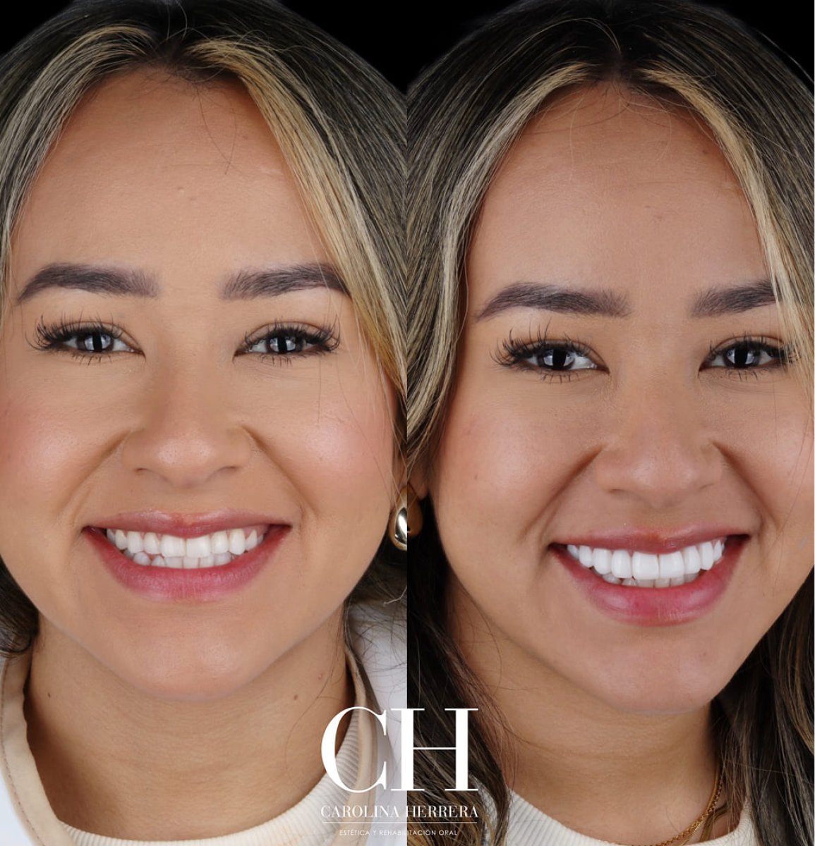 before and after photo