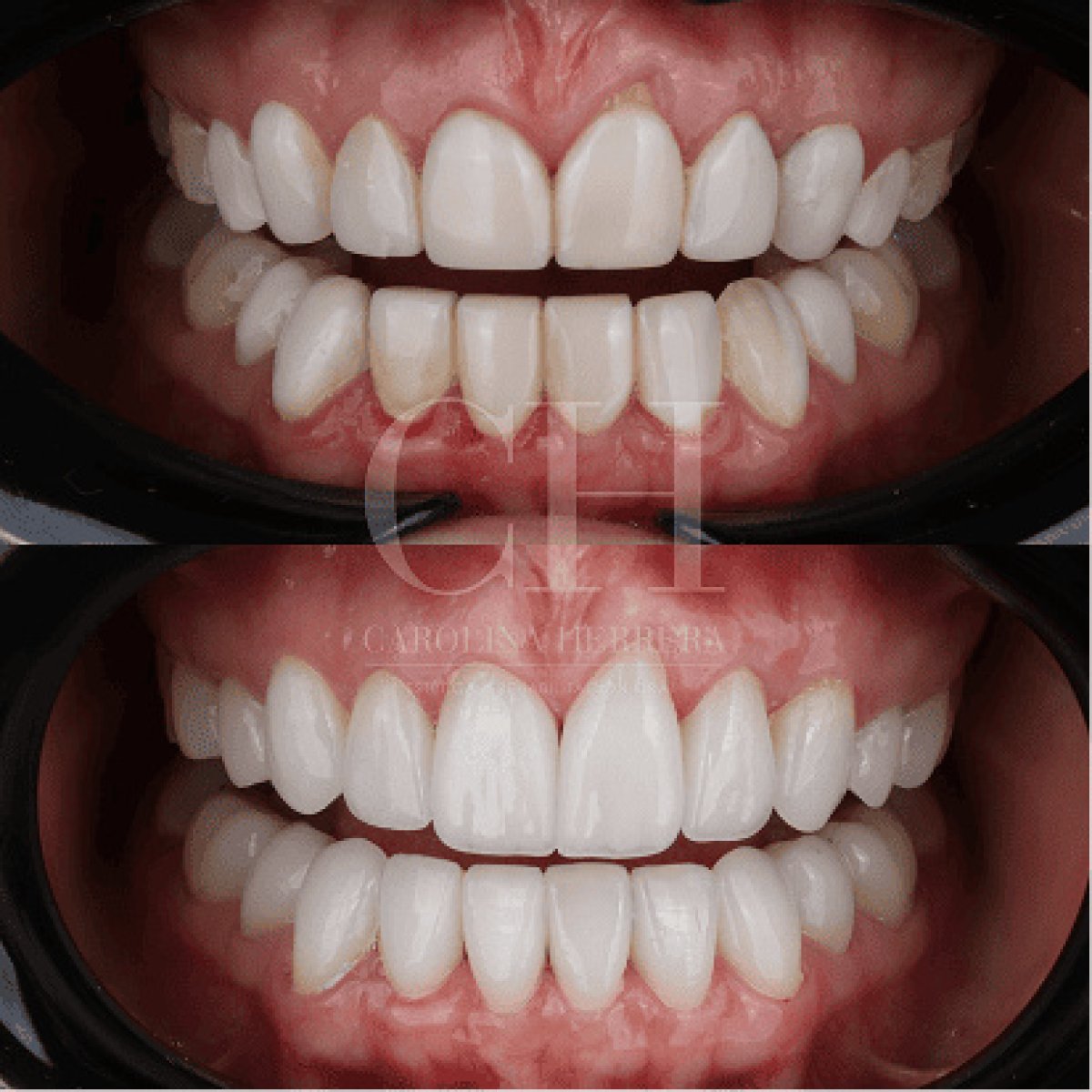 before and after photo
