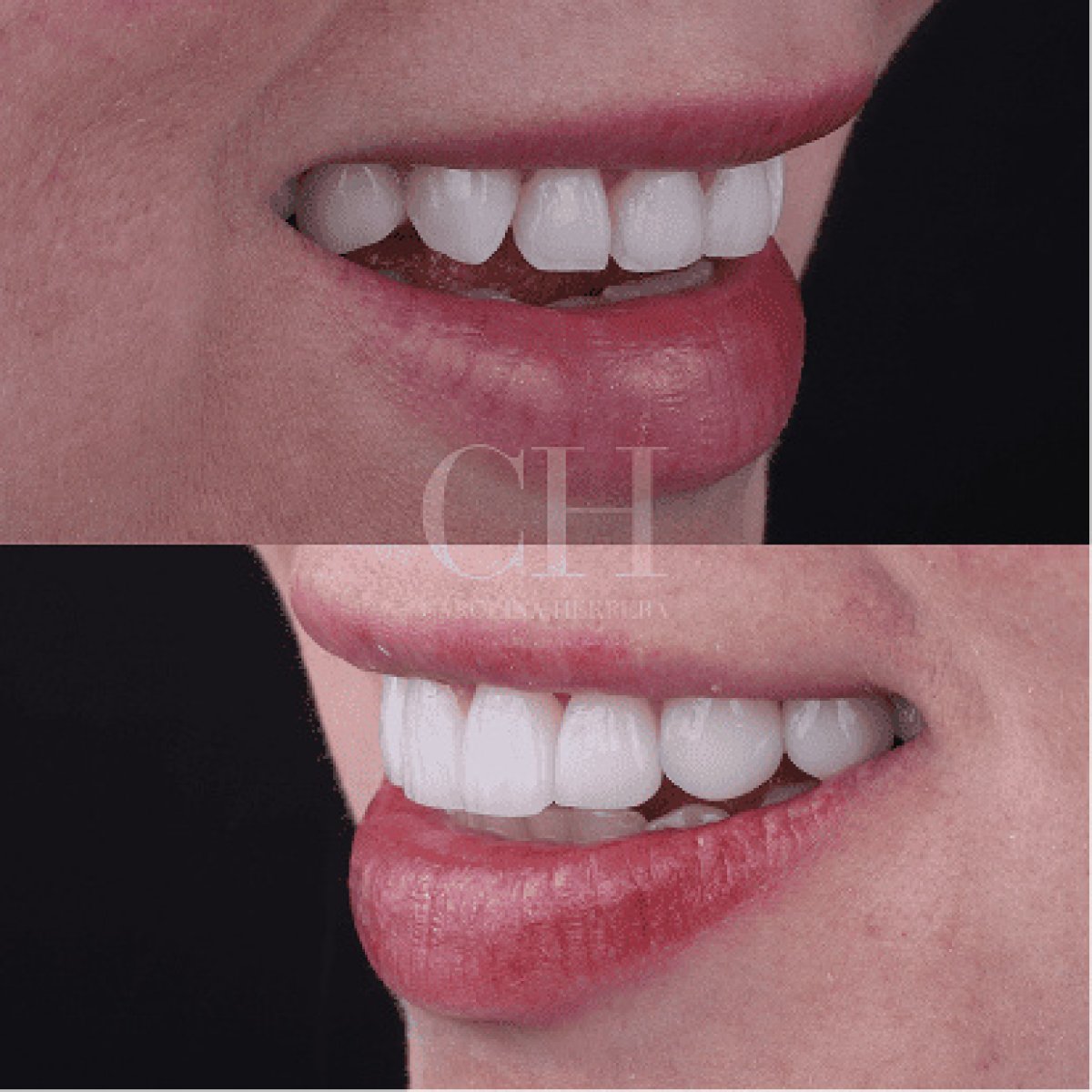 before and after photo