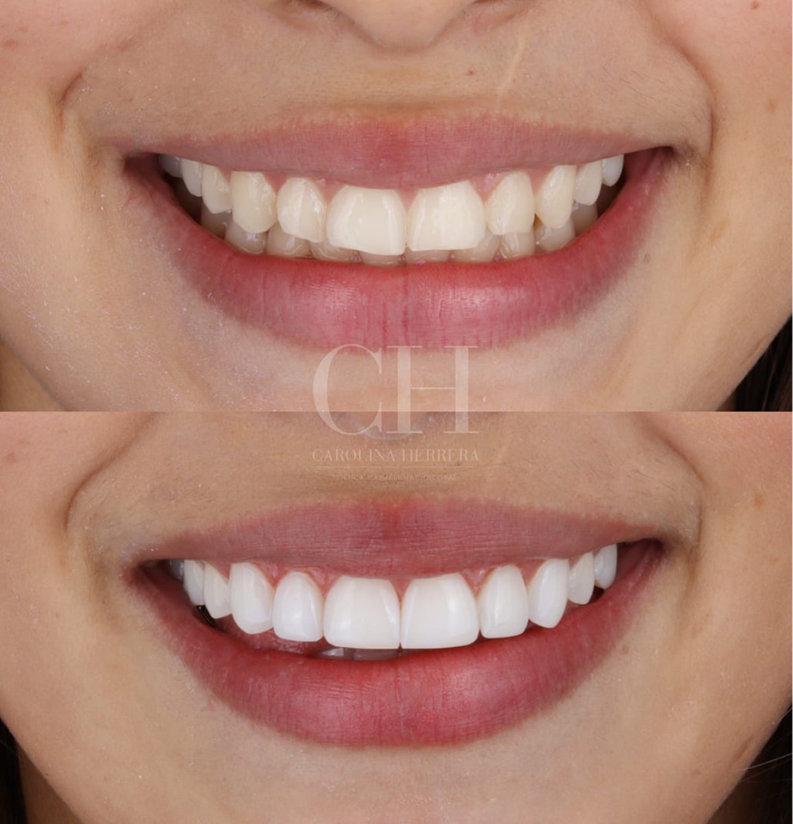 before and after photo