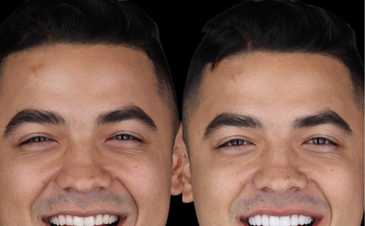 before and after photo