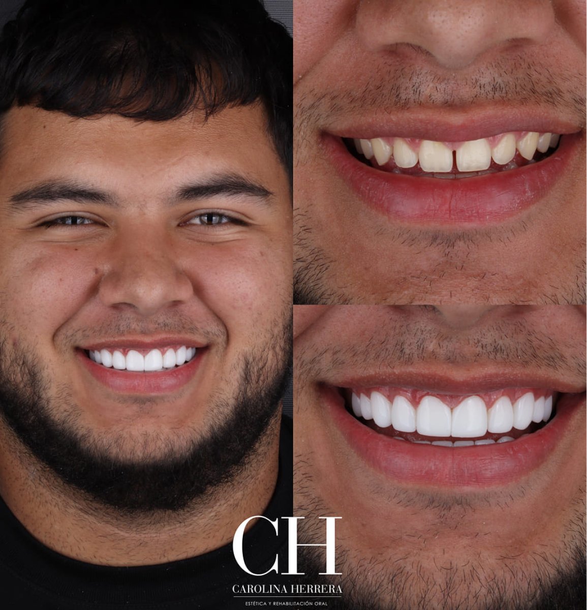 before and after photo