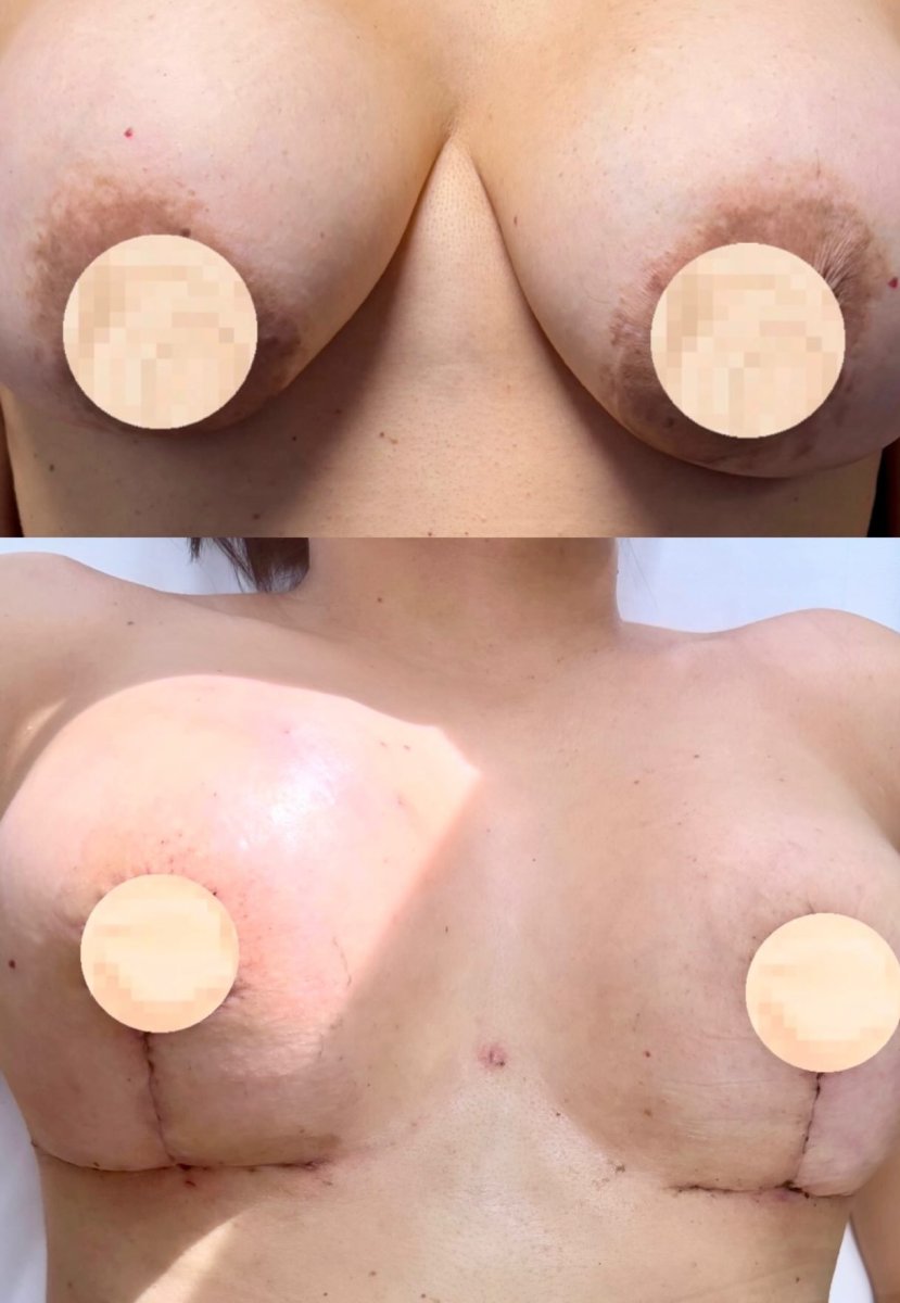 before and after photo