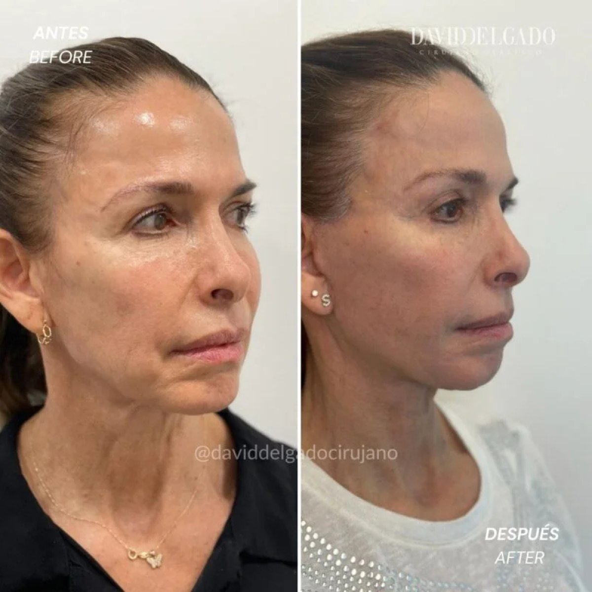 before and after photo