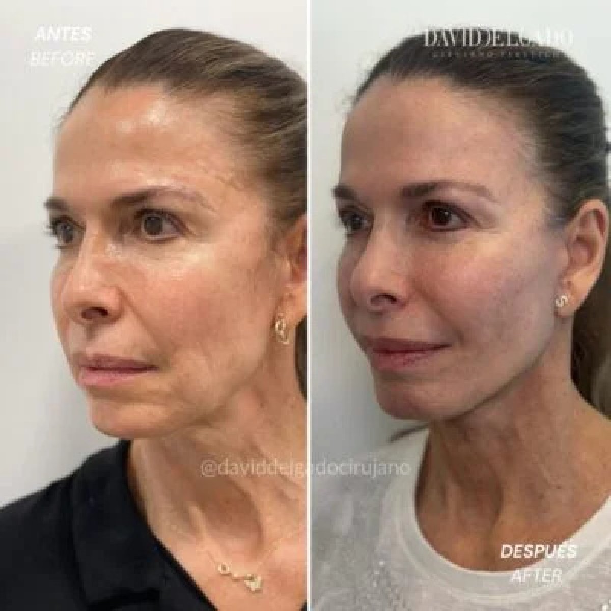 before and after photo