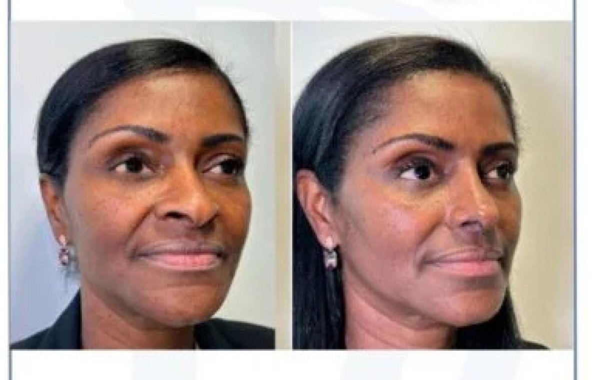 before and after photo