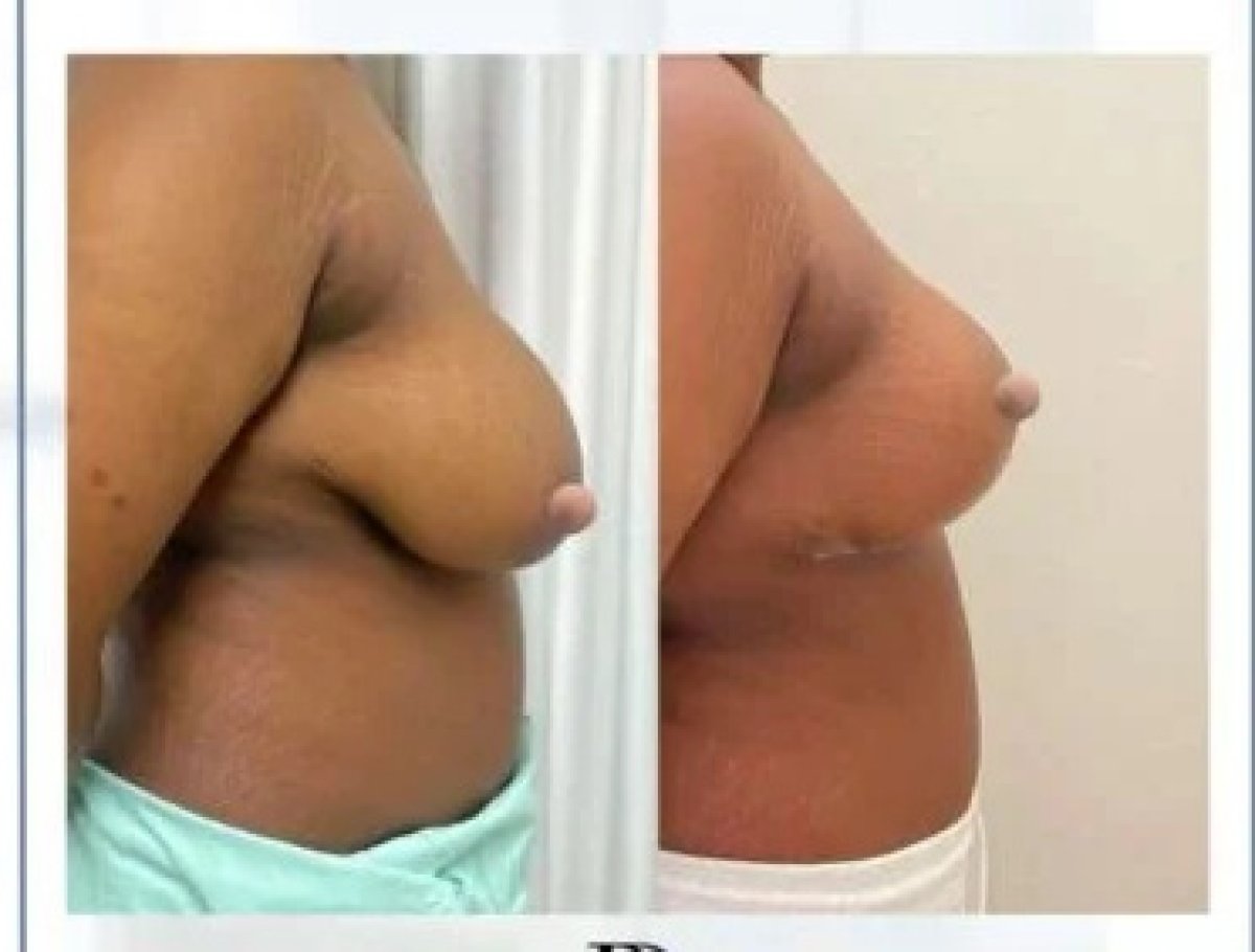 before and after photo