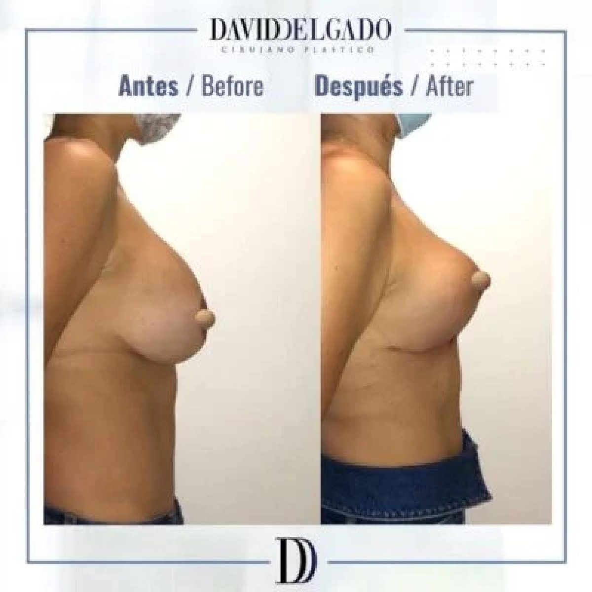 before and after photo