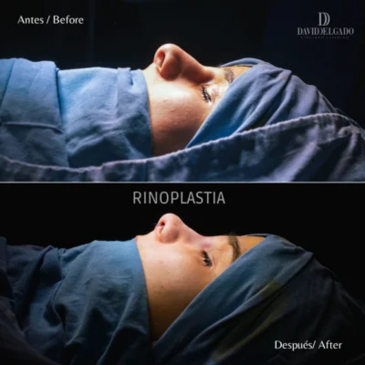 before and after photo