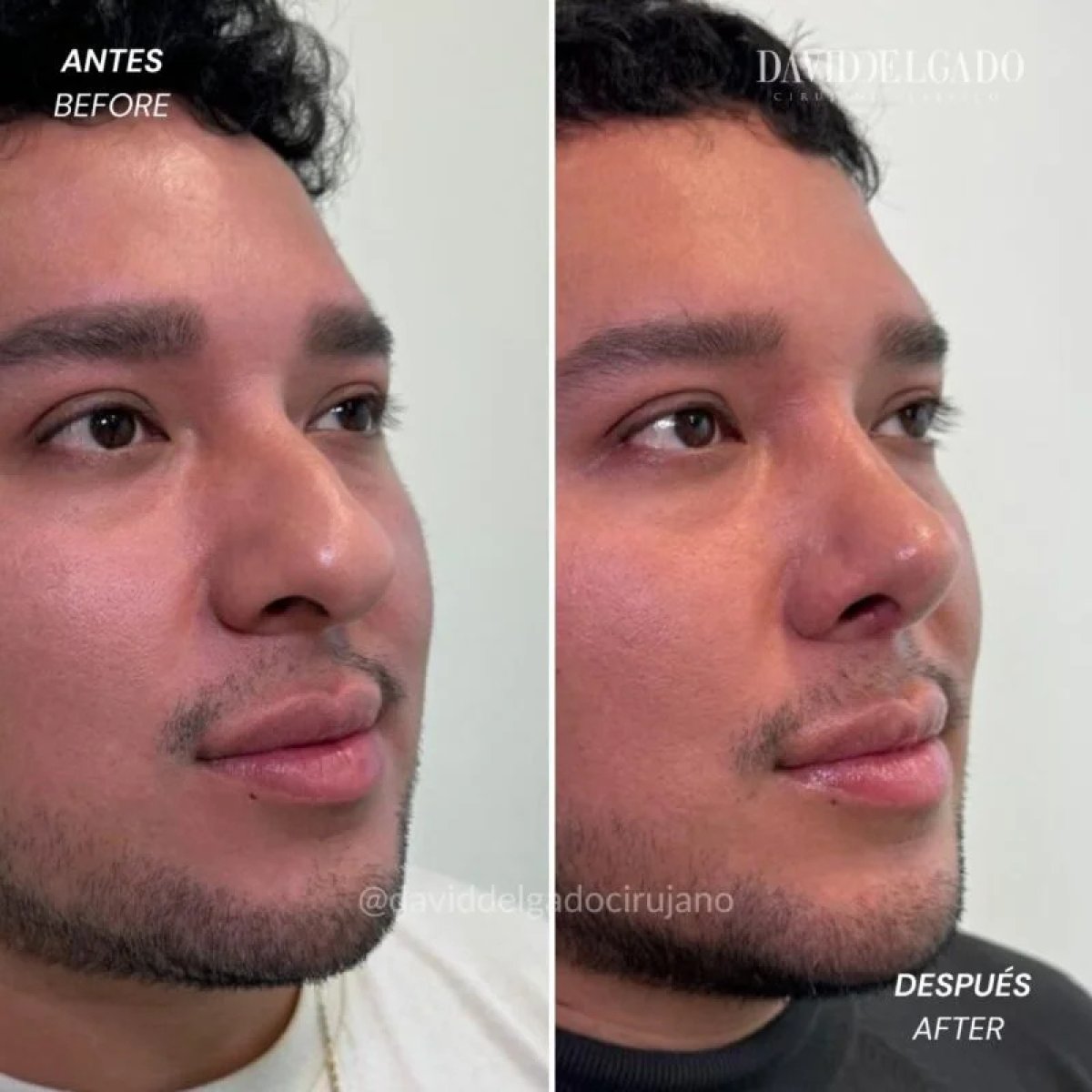 before and after photo