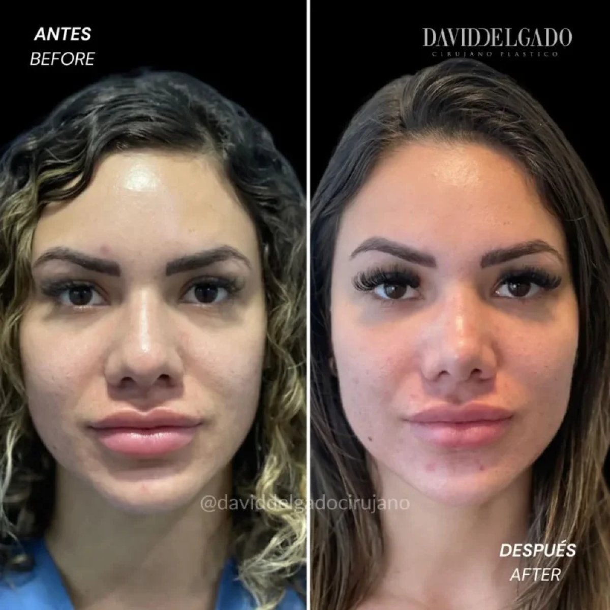 before and after photo
