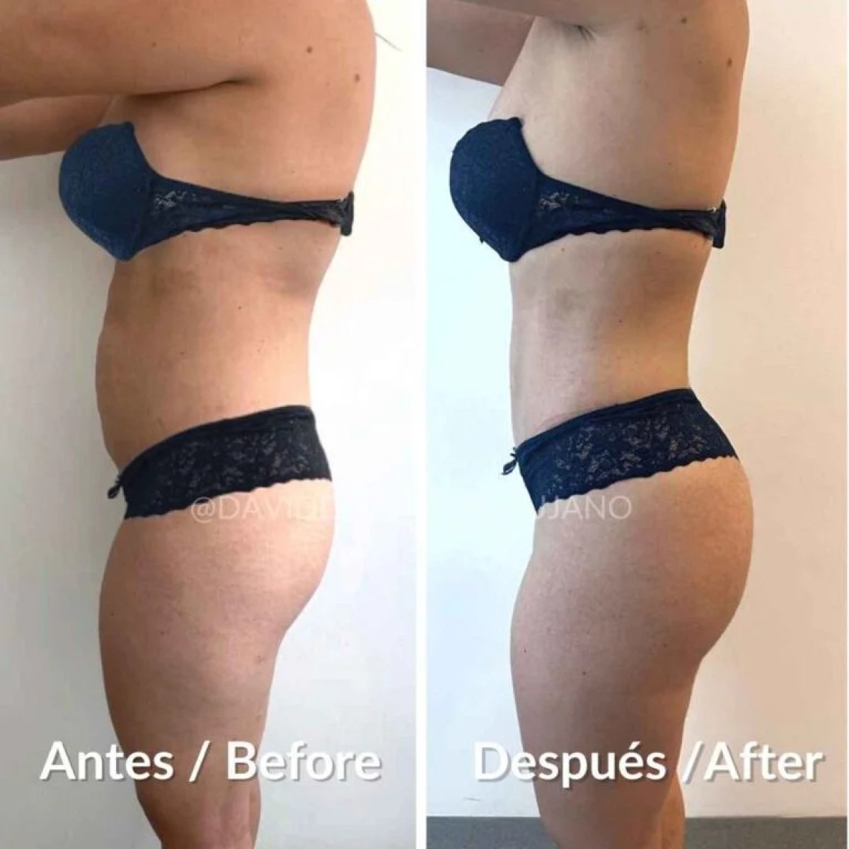 before and after photo