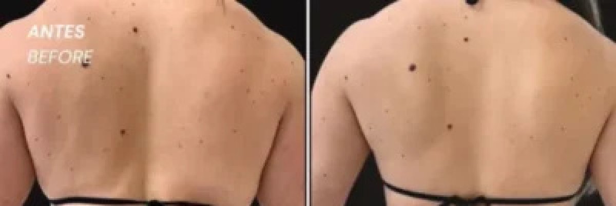 before and after photo